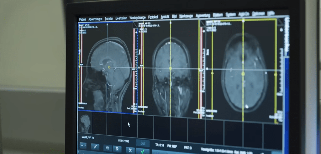 The MSU Study on School Climate and Mental Health Has One Finding That Should Change How America Funds Education