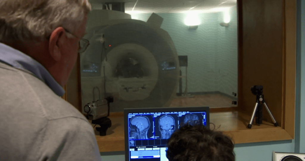 The Cognitive Reserve: How Bilingualism Is Quietly Reshaping the Future of Aging Research